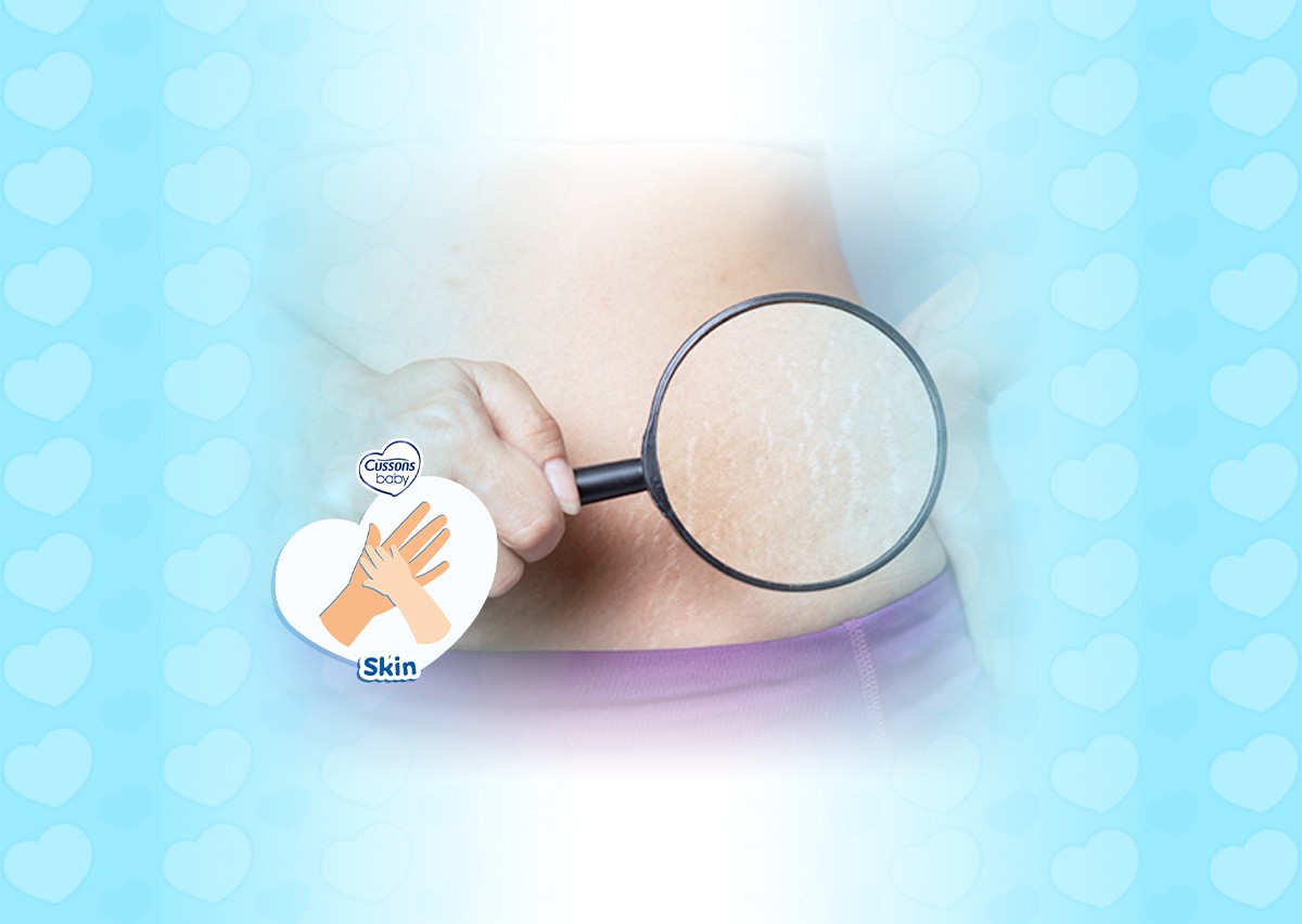 11_SKIN_Problem-Kulit-Pre-dan-Saat-Kehamilan_rev_2_11zon