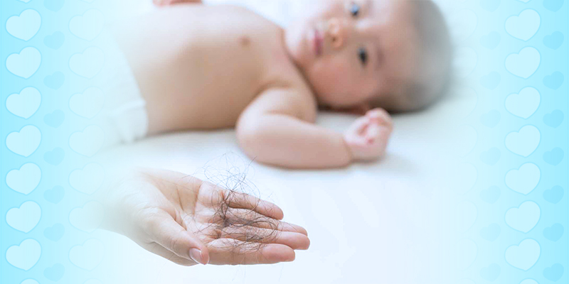 Penyebab Rambut Rontok Pada Bayi