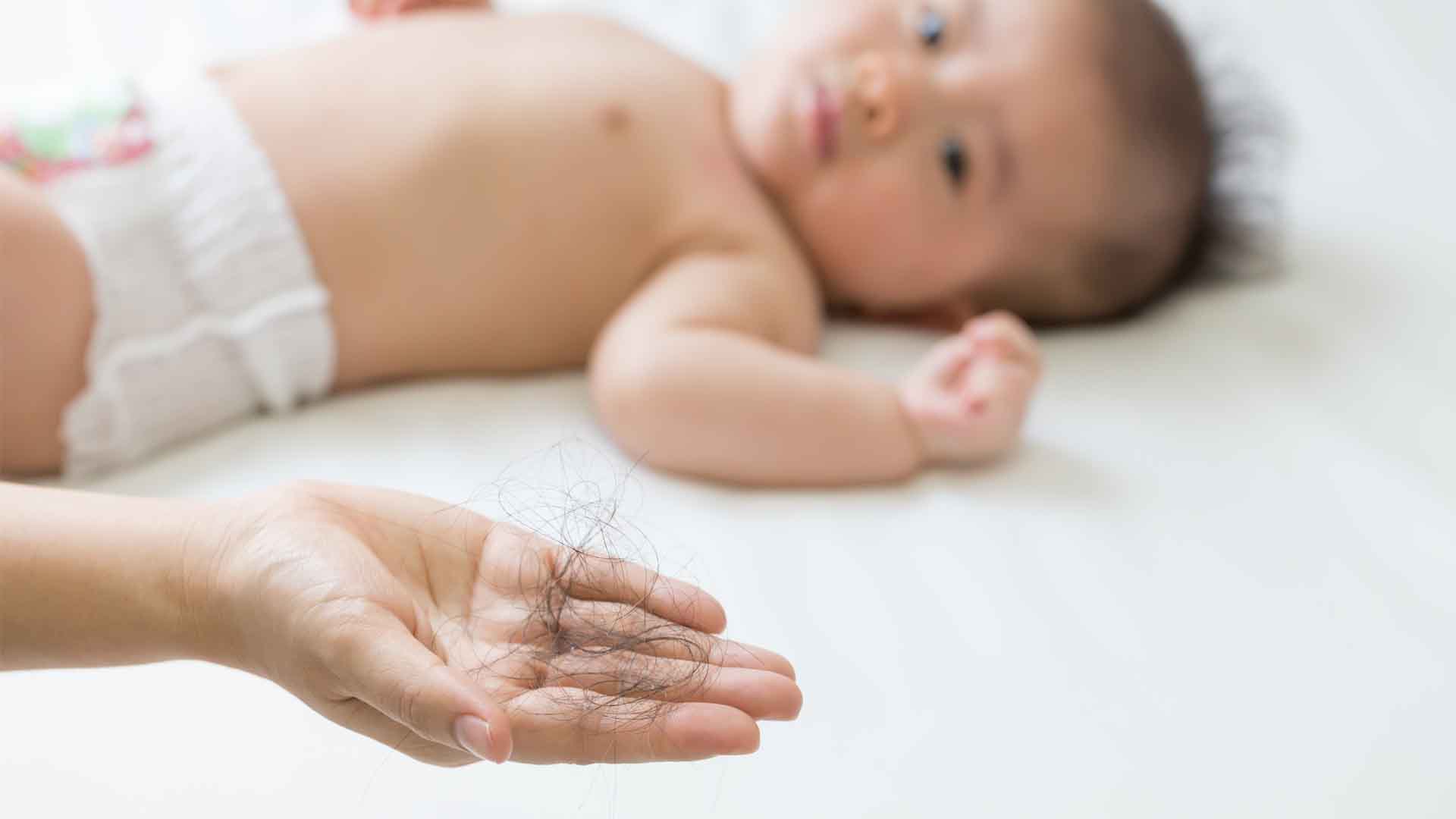  Penyebab  Rambut Rontok Pada Bayi Cussons Baby Indonesia