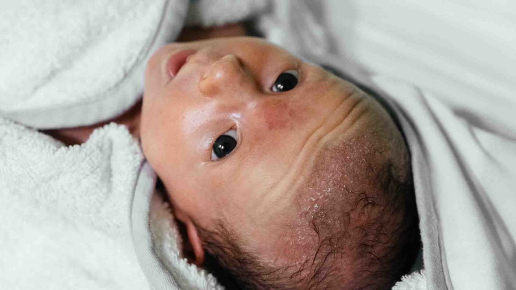 ramuan seledri untuk rambut