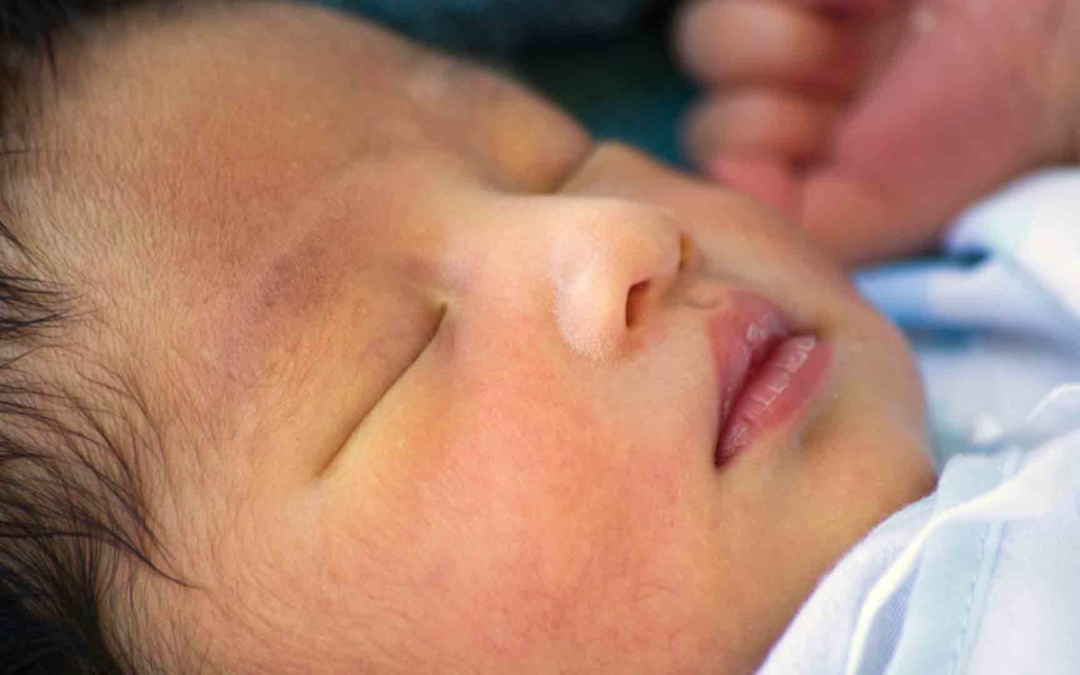 Bayi Kuning, Normalkah? Ini Cara Mengatasinya!