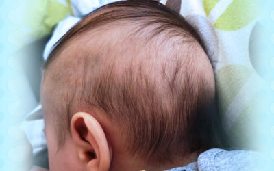 Serba-Serbi Rambut Bayi Baru Lahir Tidak Tumbuh Merata