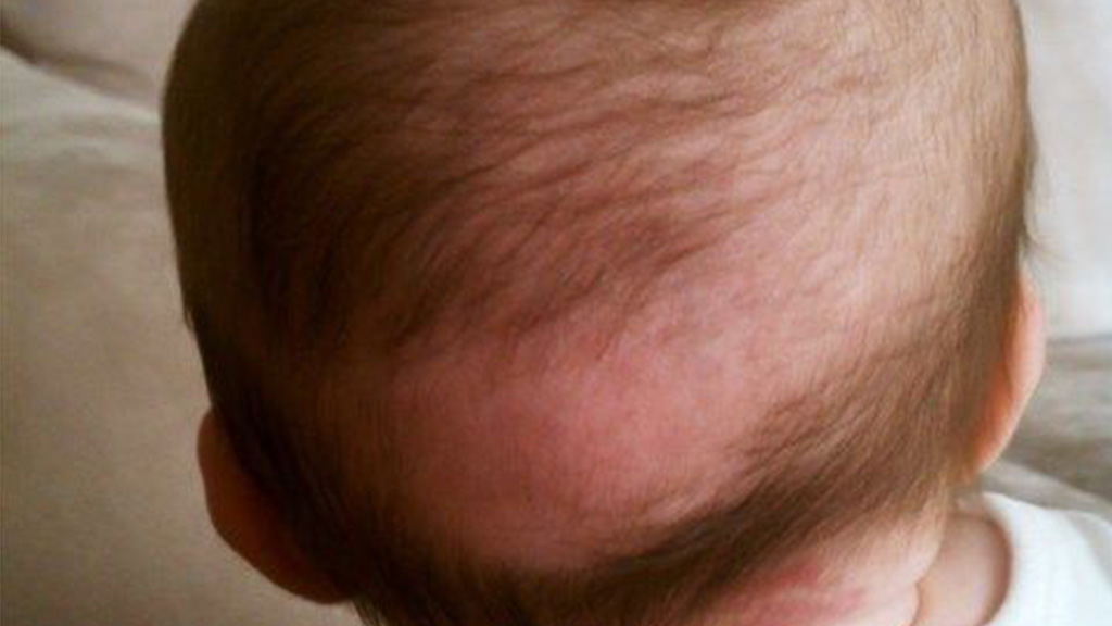 Mengapa Rambut bayi baru lahir tumbuh tidak rata