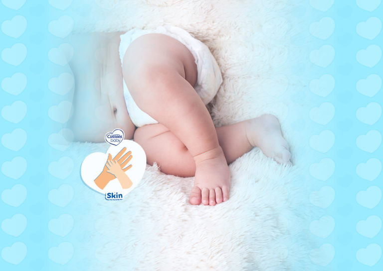 Kulit kering pada bayi