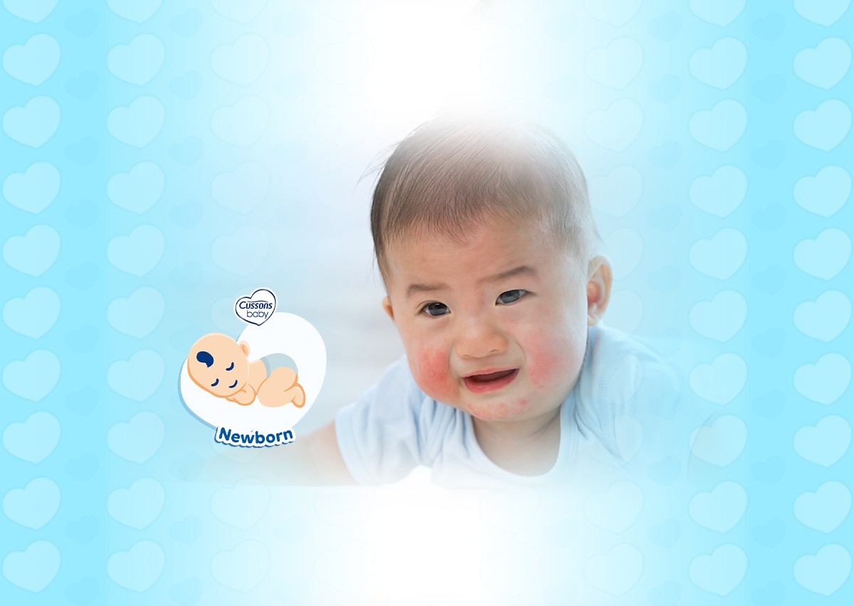 36_NEWBORN_Ruam Merah – Cara Menghilangkan Gatal_11zon
