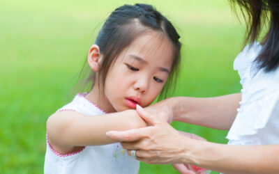 Alergi Kulit pada Anak: Penyebab, Gejala, dan Cara Mencegahnya