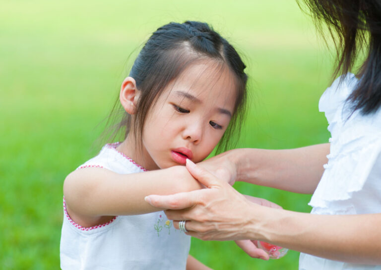 alergi kulit pada anak