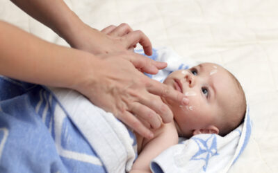 5 Cara Mengatasi Ruam Kulit Karena Susu pada Anak