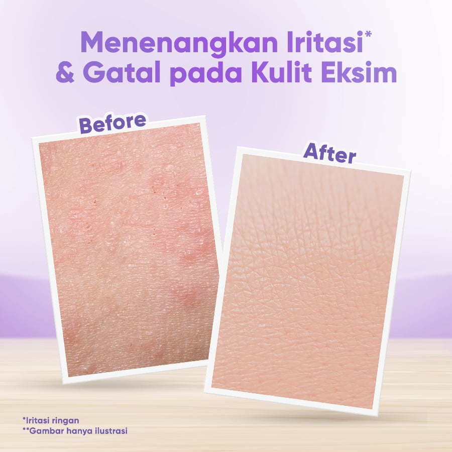 Cussons Baby Lotion Sensicare Daily Moisture